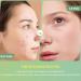 Buy ZONTO Essential Oil Acne Patch - Fast International Shipping for Clear Skin - Buy Online on GoSupps.com
