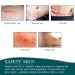 Silicone Scar Sheets Roll - Professional Scar Removal Tape for C-Section, Surgery, Burn, Acne - 1.6 x 120 Roll-3M - Buy Online on GoSupps.com