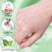 216PCs Hydrocolloid Pimple Patches - Invisible Waterproof Acne Treatment for Fast Healing | Two Sizes Available - Buy Online on GoSupps.com