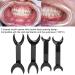 4-Piece Dental Cheek Holder Set | T-Shape Intraoral Lip Openers for Tooth Whitening | Mouth Opener & Tooth Holder - Buy Online on GoSupps.com
