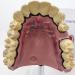 Upikit Dental Model for Sick Teeth - Compare Smoking vs Normal Teeth | Ideal for Medical Demonstrations - Buy Online on GoSupps.com
