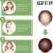 fanelod Hair Growth for Women - Natural Ginger Hair Growth Serums 20ML Biotin Hair Growth - Nourishing Ginger - Buy Online on GoSupps.com