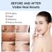 Tongyend Dark Spot Correcting Glow Serum Facial Serum Brightening Essence Dark Spot Correcting Glow Serum Brightening Serum Skin Lightening Cream for Dark Skin Collagen Boost Anti Aging Aerum - Buy Online on GoSupps.com