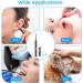 1080P HD Ear Wax Removal Kit with WiFi Endoscope Otoscope - LED Lights, Earwax Remover Tools for iPhone, iPad, Android - Black - Buy Online on GoSupps.com