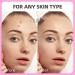 EFLY Hydrocolloid Pimple Patches with Tea Tree Oil & Salicylic Acid Invisible Acne Dots for Face 210 Patches - Buy Online on GoSupps.com