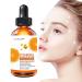 Vitamin C for Skin - Skin Care with Pure Organic Vitamin C - 1 Fl Oz Moisturizer for Daily Skin Care for Most Skin Types