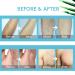 Natural Hair Removal Spray Foam - Effective & Painless Depilatory Cream for Body & Intimate Areas - Women & Men Blue - Buy Online on GoSupps.com