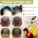 Huile de croissance des cheveux Lifewitqueenp Queenp Ayurvedic Hair Growth Huile l ger pour tous les types de cheveux 1Pcs - Buy Online on GoSupps.com