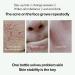 Acne Repair Face Serum Firming Serum For Face Green Tea Hyaluronic Acid Serum Relieve Redness & Acne Natural Face Serum For Acne Day & Night Serum For Face Hydrating Face Oils And Serums-Repair - Buy Online on GoSupps.com