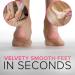 MEGAFILE XL Callus Remover Foot File by NYK1 - Foot Scrubber for Dead Skin Removal - Hard Skin Foot Callus Remover - Pumice Stone for Feet - Buy Online on GoSupps.com