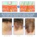 100g Nourishing Hair Scrub for Scalp Exfoliation Deep Cleansing Scalp Scrub to Unclog Follicles Remove Buildup & Promote Healthier Hair Growth - Buy Online on GoSupps.com
