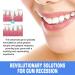 Professional Gum Therapy Gel & Teeth Whitening Essence | Sensitive Teeth Stain Remover & Repair Gel - Safe Tooth Bleaching - Buy Online on GoSupps.com