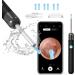 QDCFY Otoscope Ear Camera 1080P HD 3.5mm Ear Cleaning Tool for IOS and Android Smartphones (White) Black