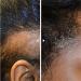Gel d soxyribose au sucre pour la croissance des cheveux pour le traitement de la perte de cheveux favorise la repousse et r duit la croissance des cheveux gel de sucre pour cheveux (2 pi ces) 2 pi ces. - Buy Online on GoSupps.com