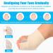 Bunion Corrector with Gel Pads - Toe Straightener Splint for Hammer Toes & Hallux Valgus - Buy Online on GoSupps.com