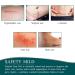 Silicone Scar Sheets 1.6 x 120 Large Roll - Waterproof Soft Strips for Acne, C-Section, Keloid, and Burn Scars - Skin Care - 10-12 Month Supply - Buy Online on GoSupps.com