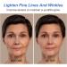 Boto-xface Stock Solution Facial Serum Boto-xface Face Cream Anti Aging Serum for Face Collagen Boost Anti-Aging Serum Face Tightening Serum Boto-xface Injections Reduce Fine Lines - Buy Online on GoSupps.com