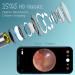 Ear Wax Removal Kit with 1920P HD Camera - Ear Cleaner for iPhone, iPad, Android Phones - 8 Pcs Ear Set - Black - Buy Online on GoSupps.com