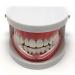Alayna Kids Mouth Guard for Teeth Grinding - 10 PK Night Guard for TMJ Bruxism - No Boiling or Molding - Pain Relief for Children - Buy Online on GoSupps.com
