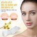 Nose Strips 80 Packs Blackhead Remover Pore Strips Blackhead Pore Strip Deep Cleansing Nose Strips for Clearer Skin White - Buy Online on GoSupps.com