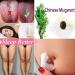 60 Pieces Mugwort Navel Sticker - Natural Herbal Detox Plaster for Belly Fat Reduction | Herbal Remedies for Belly & Waist - Buy Online on GoSupps.com