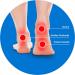 BODYTONIX Plantar Fasciitis Night Splint for Arch and Heel Pain Relief - Achilles Tendonitis Support Medium (UK 5-8) - Buy Online on GoSupps.com