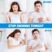 Anti-Snoring Solutions: 2 Rail & 8 Nasal Spreaders | Reusable Sleep Aids for Snoring & Teeth Grinding - Buy Online on GoSupps.com