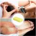 High-Quality Bimsstein Bar & Pumice Stone Foot Scrubber for Cracked Heels | Pedicure Foot Fish & PU Footstone - Exfoliate Dead Skin & Achieve Healthy Feet - Buy Online on GoSupps.com