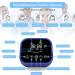 Hand Rehabilitation Robot Glove Arthritis Stroke Glove Electric Stroke Therapy Equipment Physiotherapy Device for Hemiplegia Finger Training(Size:S Color:Left Hand) Small Left Hand - Buy Online on GoSupps.com