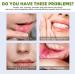 Mouth Ulcer Treatment Spray Mouth Ulcer Spray Mouth Ulcer Relief Spray Canker Sore Treatment Ulcer Treatment Tongue Breath Spray for Bad Breath Ulcer Treatment Canker Relief Spray Mouth Freshener - Buy Online on GoSupps.com