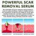 Scar Removal & Skin Repair Serum | Advanced Complex for C-Section, Surgery, Burn, Keloid & Acne | 2 Bottles - Buy Online on GoSupps.com