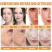 Turmeric Dark Spot Corrector Serum Turmeric Oil For Skin Wrinkles Facial Serum Natural Turmeric Face Serum for Skin Glow Dark Spot Corrector Serum Oil for Face & Body All Day Facial Moisturizer-30ml - Buy Online on GoSupps.com