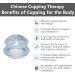 Silicone Cupping Set for Massage Therapy | Professional Transparent Massage Cups (2 x Small) - Buy Online on GoSupps.com