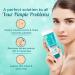 Pimple Solution Refreshing Face Wash - 100G | Clear Skin & Acne Treatment | International Shipping Available - Buy Online on GoSupps.com