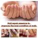 Nail Care Pen Nail Care Pen Nail Fungus Pen Health Routine Nail Care Pen Nail Care Pen Steiger Naturals Pen for Nail Fungus Against Nail Fungus Nail Care Brittle Nails Applies to All (6 Pieces) 6 pieces. - Buy Online on GoSupps.com