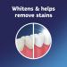 Fixodent 3 Minute Daily Cleanser Tablets Plus Scope - 90 ct - Pack of 1 | Denture Cleansing Tablets - Buy Online on GoSupps.com