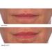 NassifMD Hydro-Screen Lip Serum with Hyaluronic Acid - Hydrating Plumping and Softening Formula for Dry Lips - Ceramide Jojoba Gloss - International Shipping Available - Buy Online on GoSupps.com