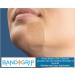 BandGrip Micro-Anchor Skin Closures Cut Kit - Wounds up to 1 Inch - Buy Online on GoSupps.com