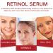 Retinol Serum For Face - Retinol Face Serum For Anti Wrinkle Dark Spot Serum For Brightening And Rejuvenating Skin - Hyaluronic Acid Serum With Retinol & Hydrolyzed Collagen - Buy Online on GoSupps.com