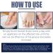 Ingrown Toenail Treatment Nail Growth Treatment Fungal Nail Treatment Ingrowing Toenail Treatment Ingrown Toenail Corrector Treatment for Ingrown Toenail Cuticle Oil Nail Strengthener for Damaged Nail - Buy Online on GoSupps.com