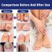 Nail Treatment Nail Repair Solution for Toenails cuticle protection & strengthening Restoring Nails 30ML - Buy Online on GoSupps.com