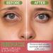 Snail Eye Patches for Dark Circles, Puffiness, and Bags (60pcs/30pairs) | Anti-Wrinkle Eye Masks with Hyaluronic Acid and Collagen | Korean Skincare - Buy Online on GoSupps.com