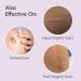TriLASTIN Silicone Scar Sheets (6 Count) - Medical Grade Silicone Scar Tape for Keloid and Bump Removal - Buy Online on GoSupps.com
