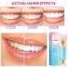 Niacinamide Whitening Toothpaste Niacinamide Toothpaste Intensive Whitens Teeth Protects Tooth Enamel Stain Removal & Freshens Breath Fuoride-Free Whitening Toothpastes for Brilliant Smile 1 - Buy Online on GoSupps.com