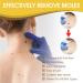 L' limination Des Acrochordons Cr me Verrues Resistantes Mains & Pieds Traitement Efficace des Verrues Verrue Remover Cr me pour le Corps et les Mains S r et Efficace 20g - Buy Online on GoSupps.com