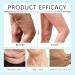 Luxelift Balm B5 Fubsta Firming Fubsta Luxelift Skin Firming Rejuvenation Butter B5 Fubsta Firming Cream Fubsta Skinfirming Gel Balm Fubsta B5 Luxelift Skin Firming Lifting Cream (1pc) - Buy Online on GoSupps.com