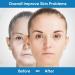 Microcurrent Face & Neck Massager for Wrinkle Reduction and Skin Tightening - Intelligent Facial Device for Contoured Beauty - Blue - Buy Online on GoSupps.com