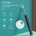 Wi-Fi Visible Wax Elimination Spoon Otoscope Endoscope Ear Spoon Ear Wax Cleaner Ear Wax Removal Kit Black Collector88 - Buy Online on GoSupps.com