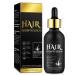 5% Minoxidil for Men and Women Hair Growth Serum - Biotin Hair Growth Oil Hair Regrowth Treatment for Scalp Hair Loss Hair Thinning Natural Hair Growth for Thicker Longer Healthier Hair 2.02 oz