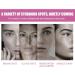 Dark Spot Remover for Face & Body Freckle Removal Cream Hyperpigmentation Treatment Freckle Removel Cream with Aloe Vera Hyaluronic Acid and Licorice Spot Cream Reduce Dark Spots & Soften Skin - Buy Online on GoSupps.com